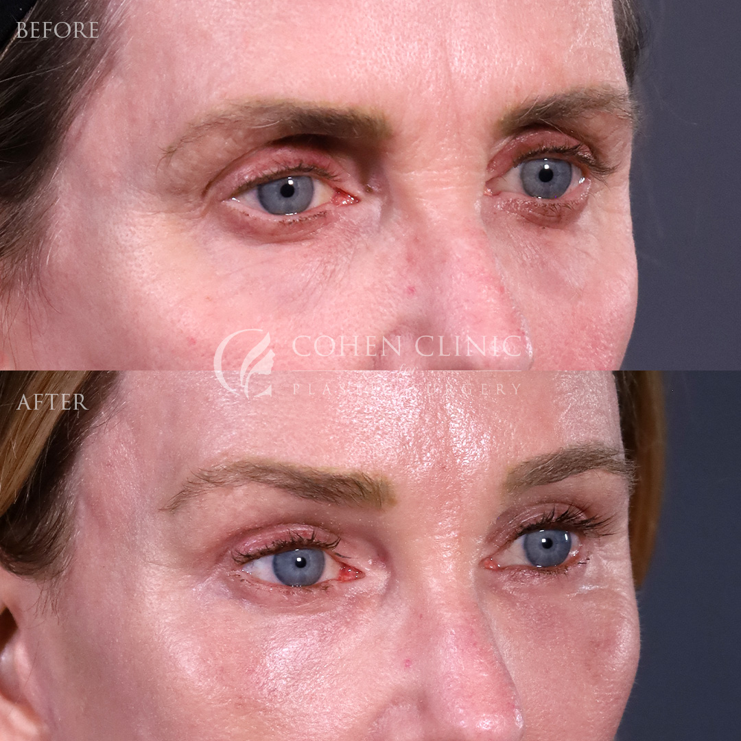 Case 11544 Marge Image