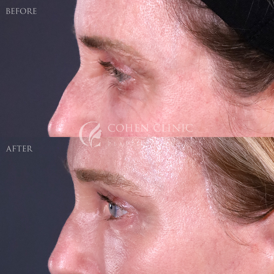 Case 11544 Marge Image