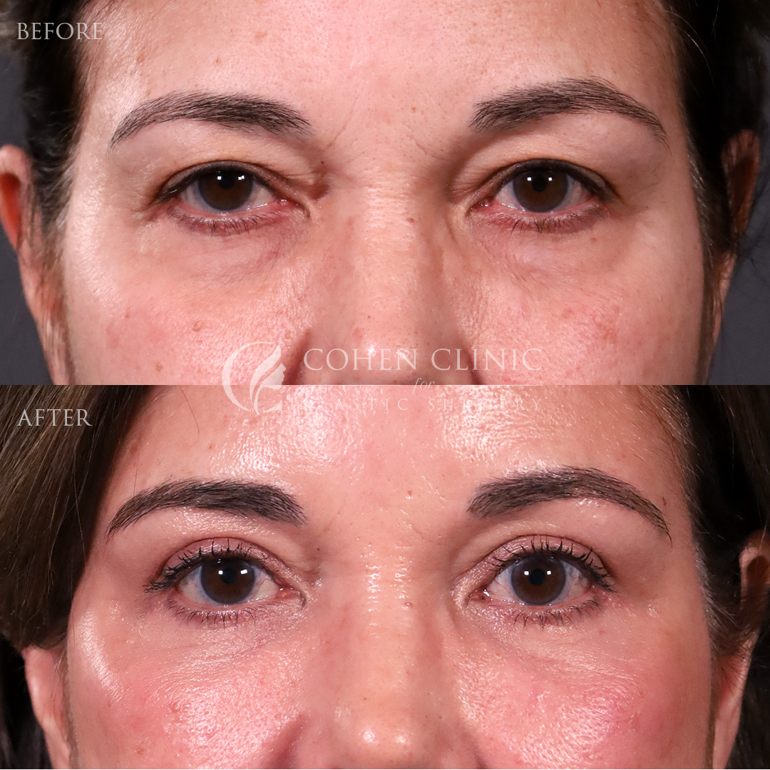 Case 00245 Marge Image