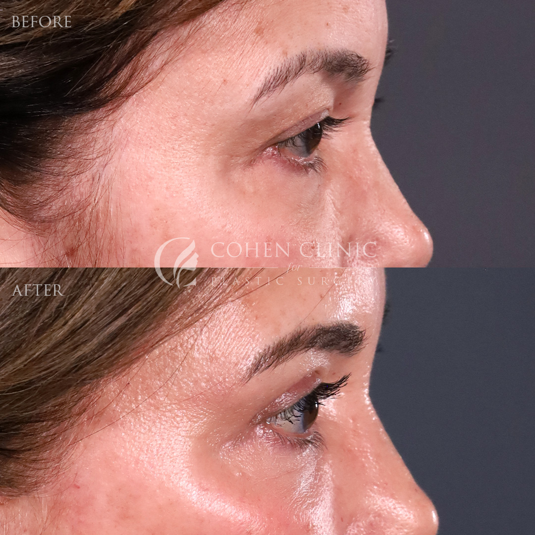 Case 00245 Marge Image