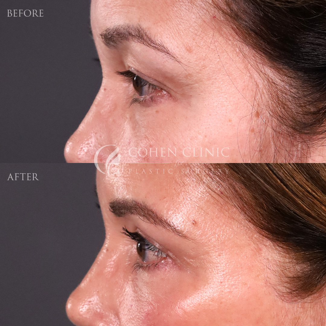 Case 00245 Marge Image