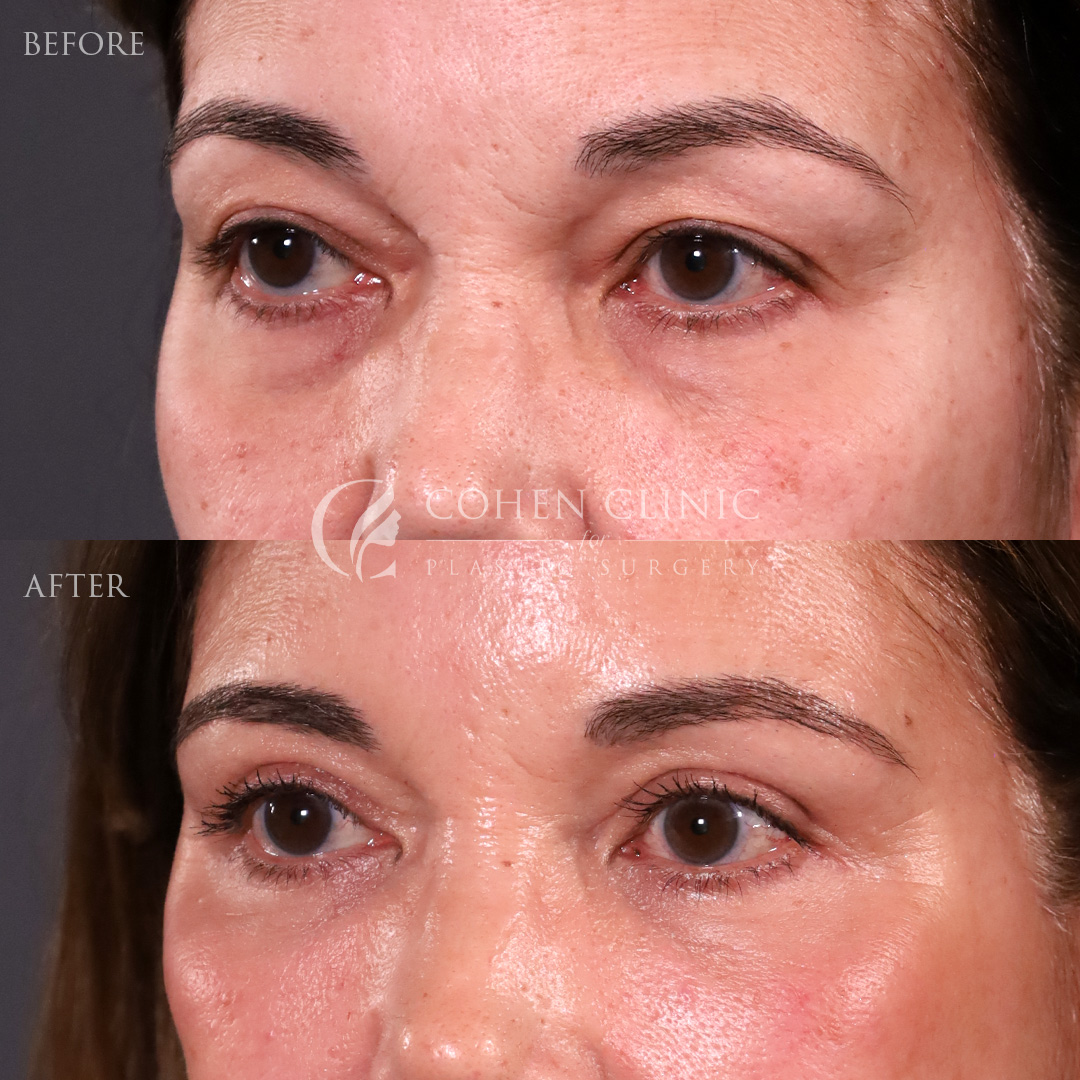 Case 00245 Marge Image