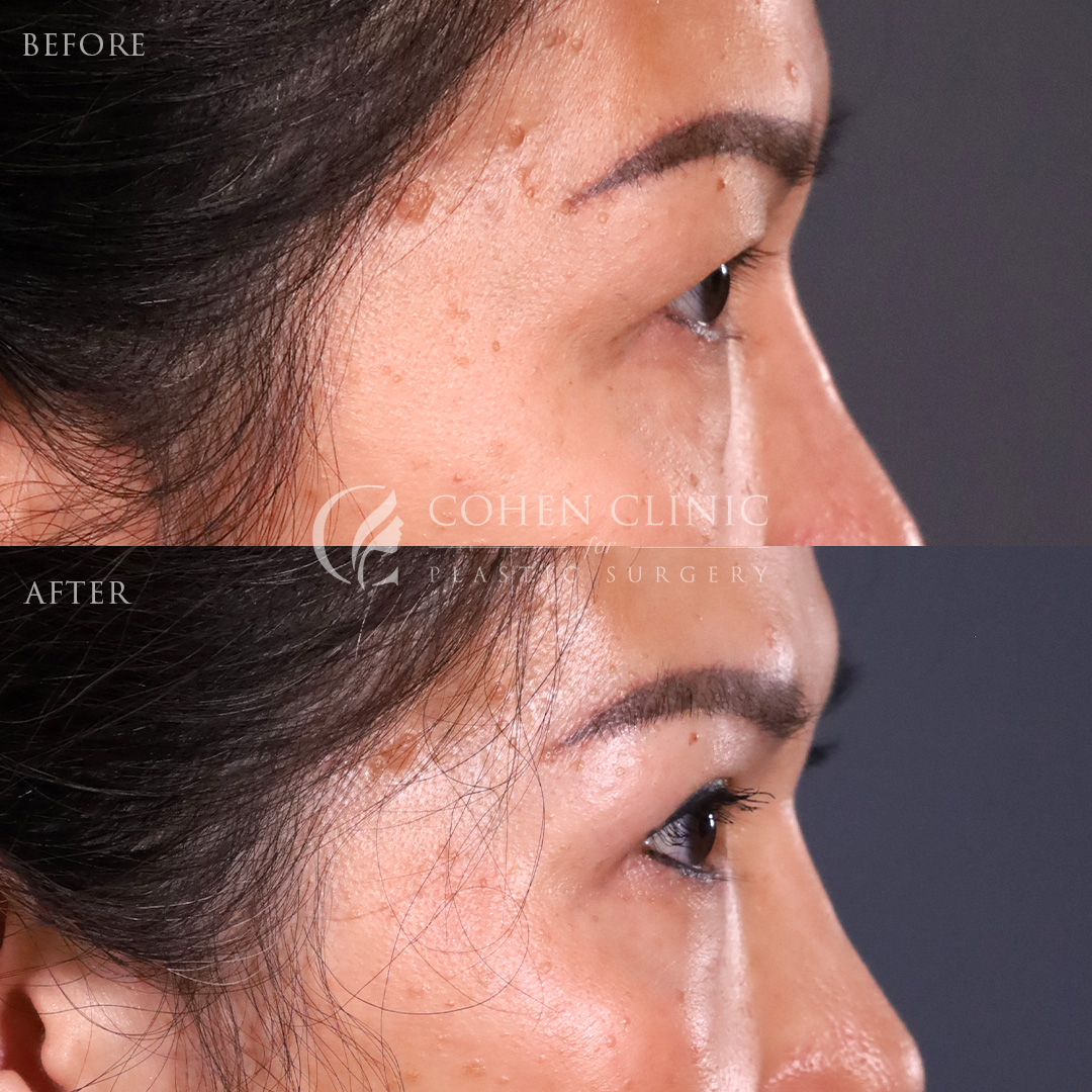 Case 55777 Marge Image