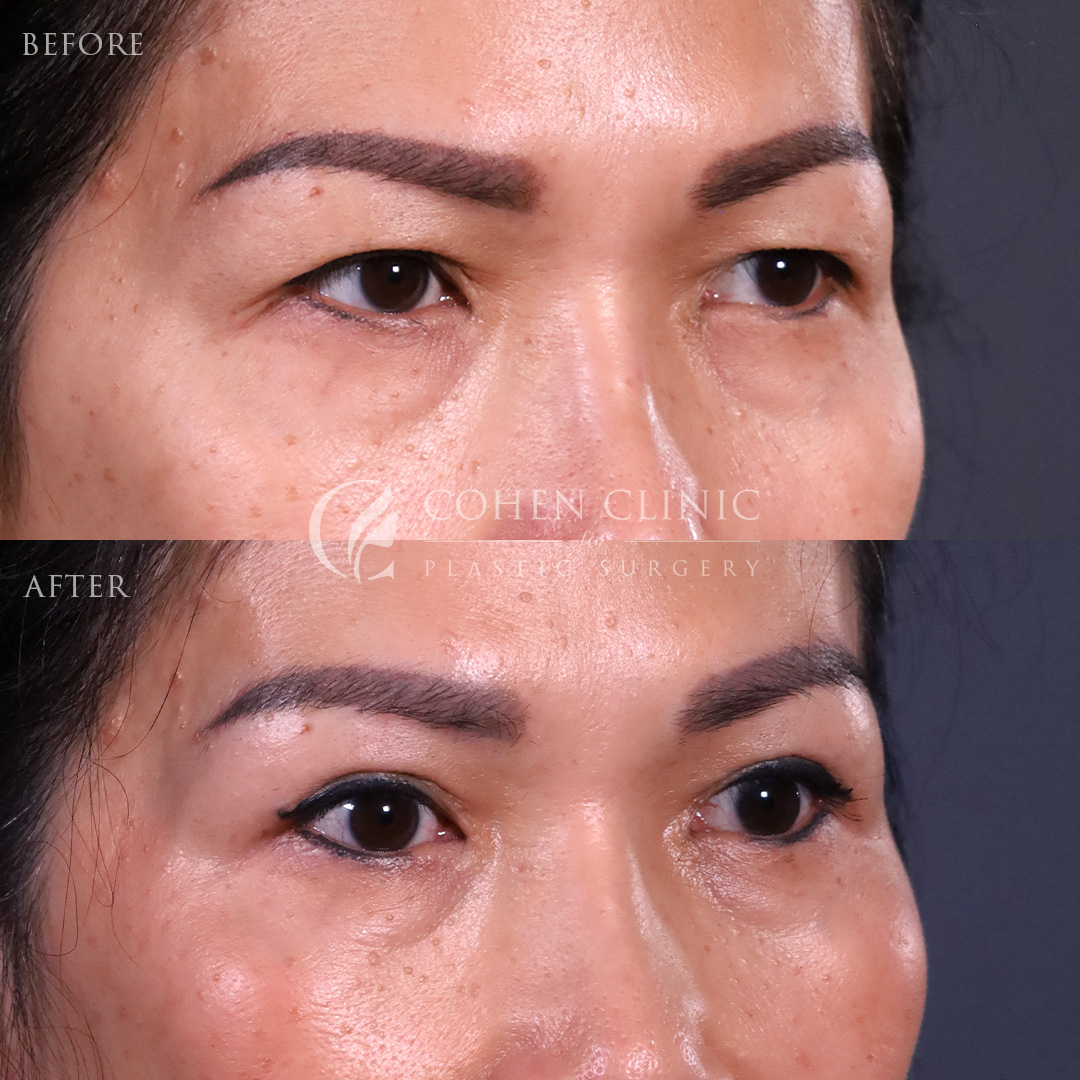 Case 55777 Marge Image