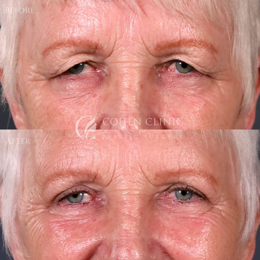 Case 78996 Marge Image