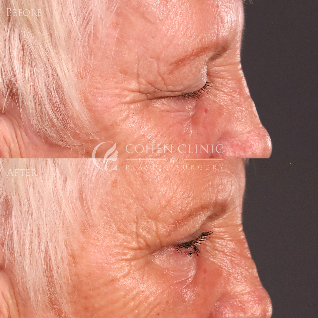 Case 78996 Marge Image