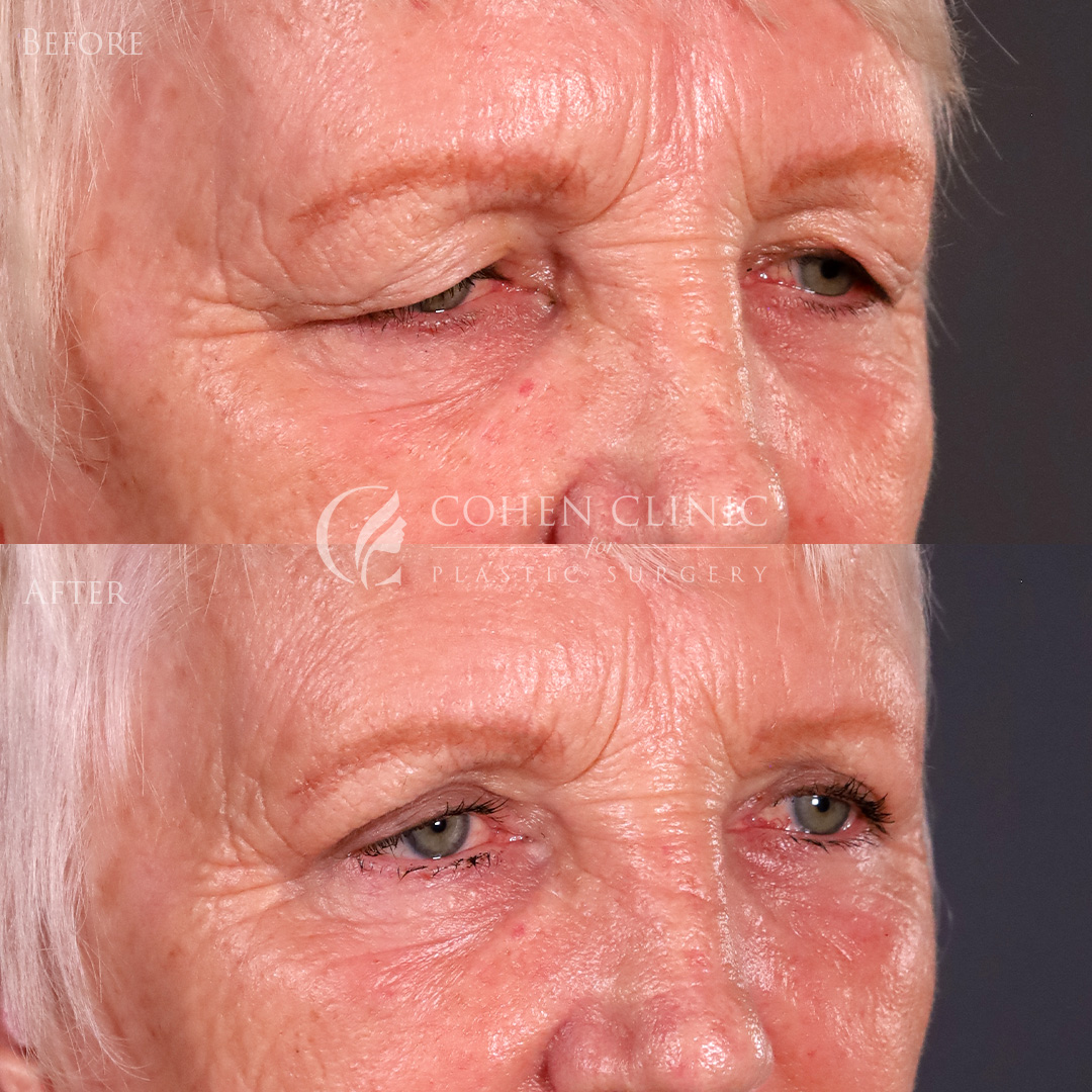 Case 78996 Marge Image