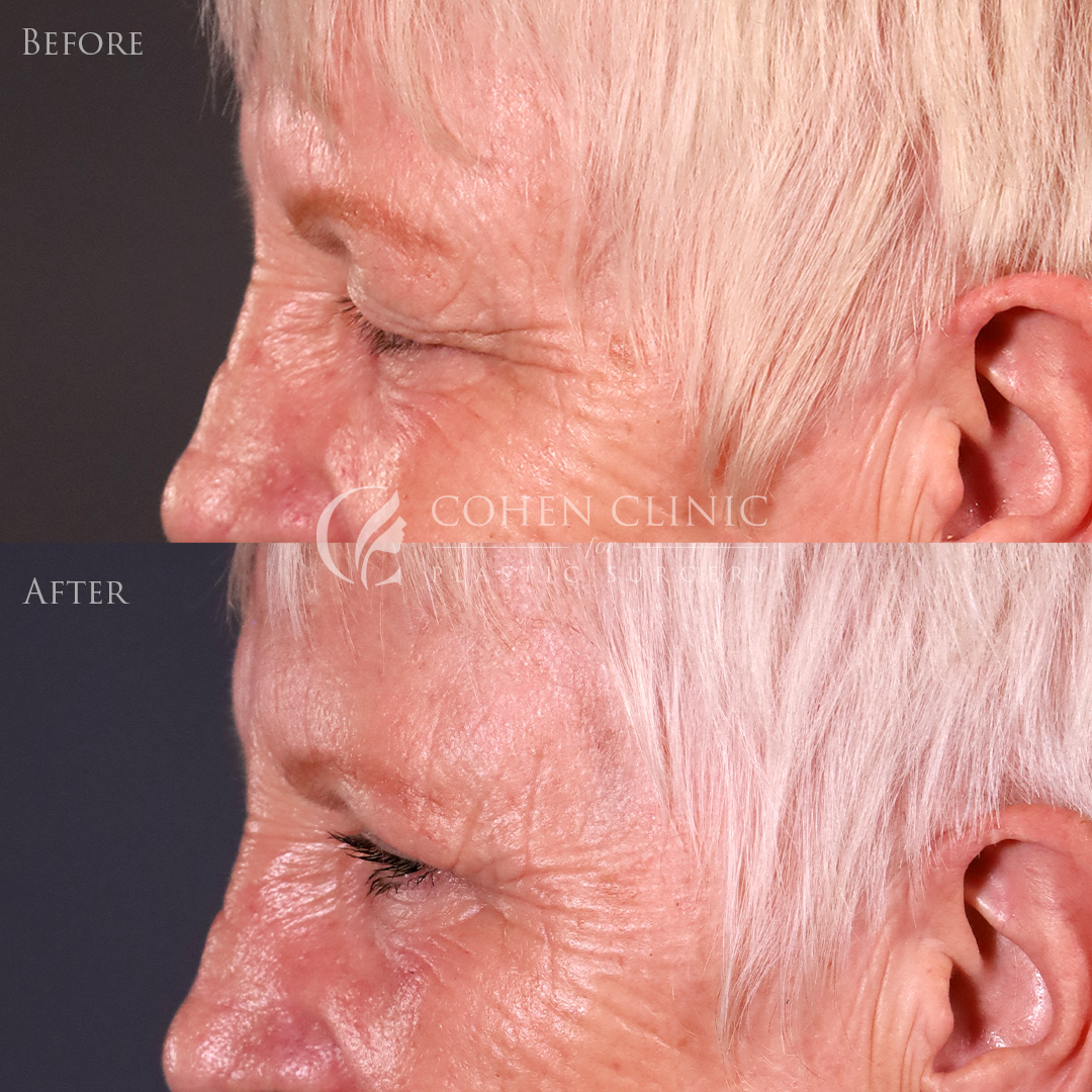 Case 78996 Marge Image