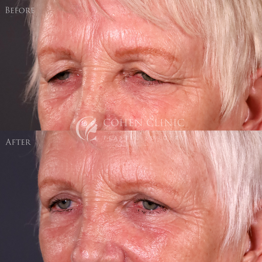 Case 78996 Marge Image