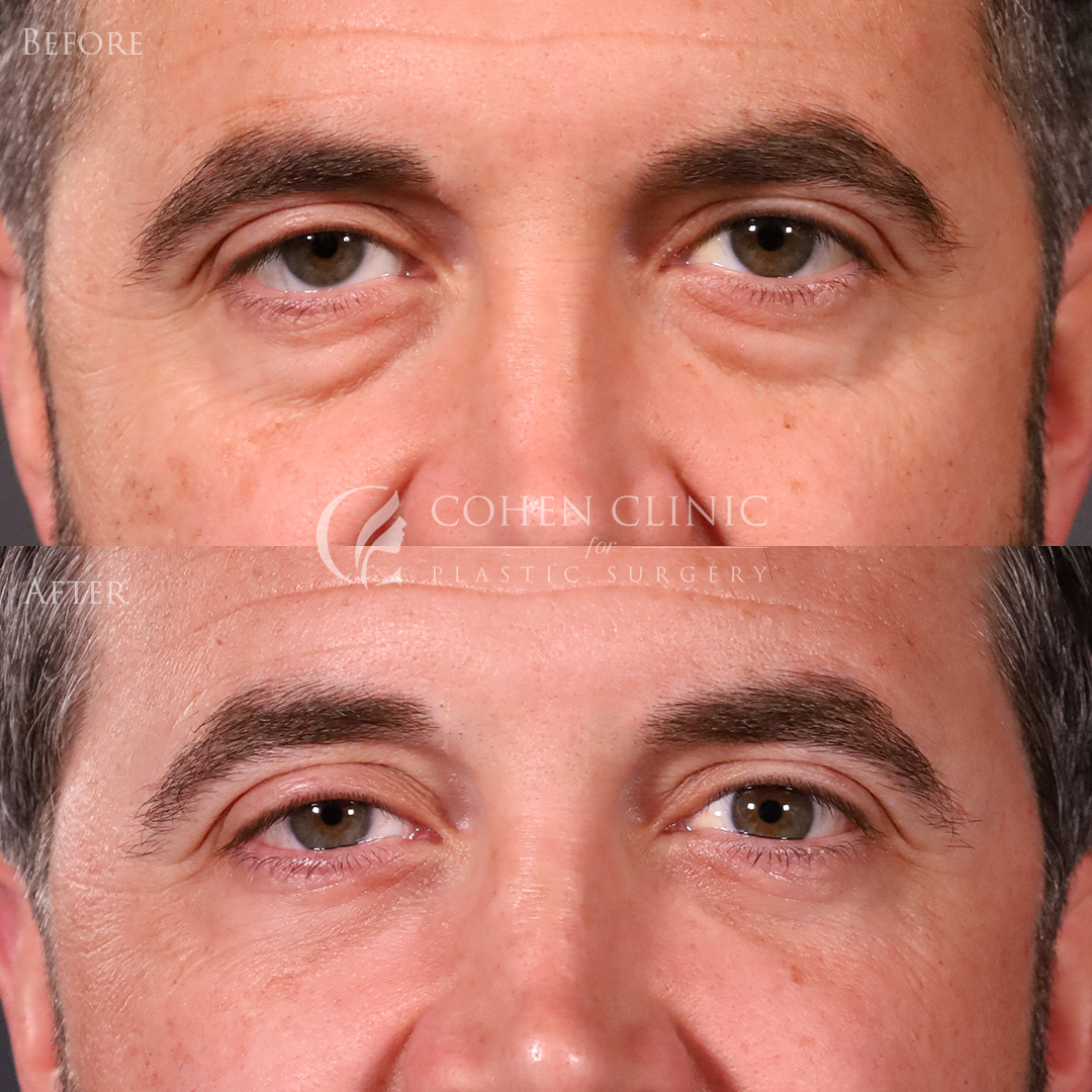 Case 00114 Marge Image