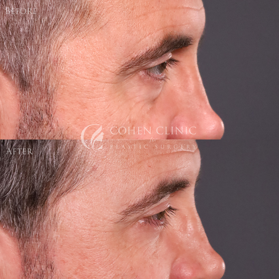 Case 00114 Marge Image