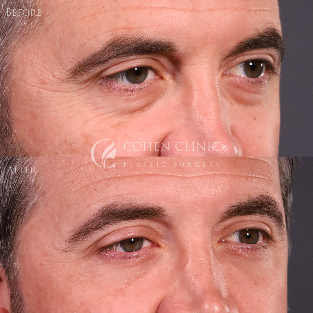 Case 00114 Marge Image