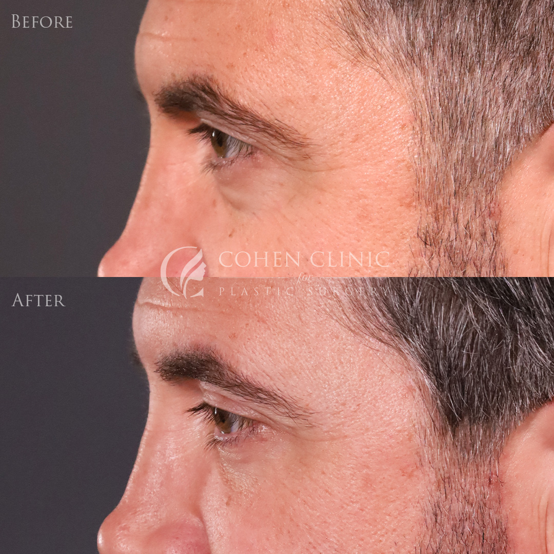 Case 00114 Marge Image