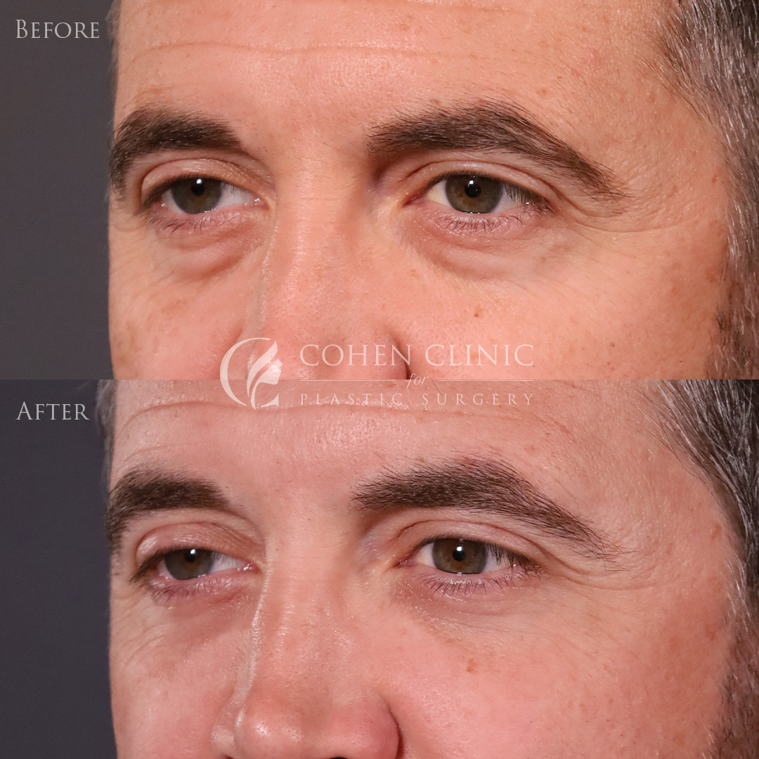 Case 00114 Marge Image