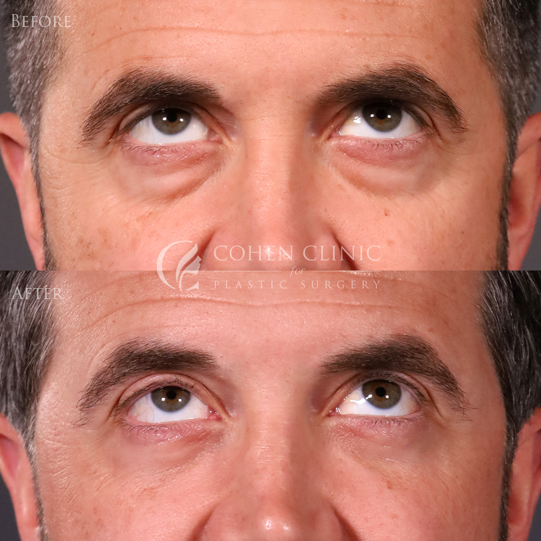 Case 00114 Marge Image