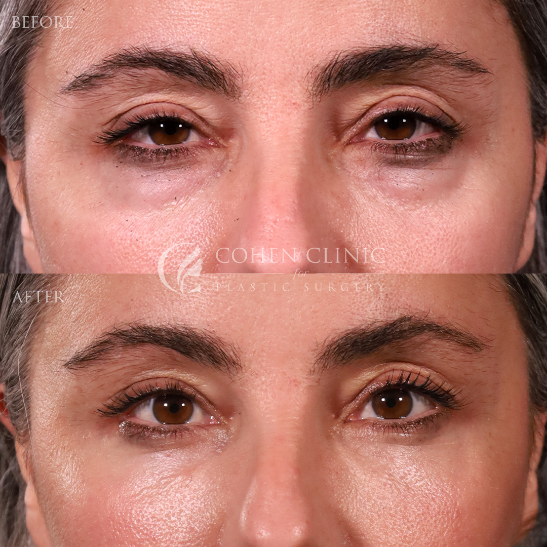 Case 34557 Marge Image