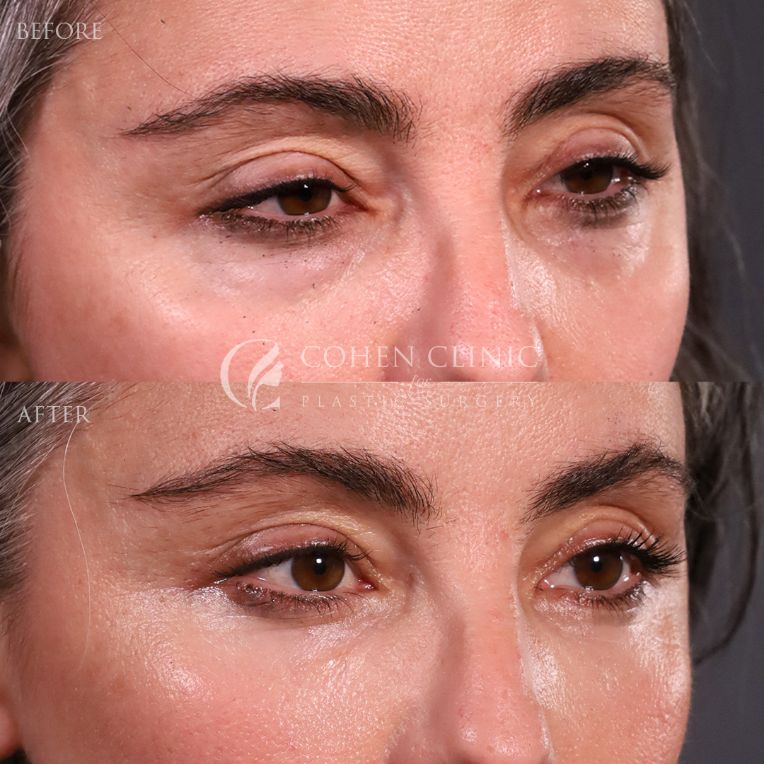 Case 34557 Marge Image