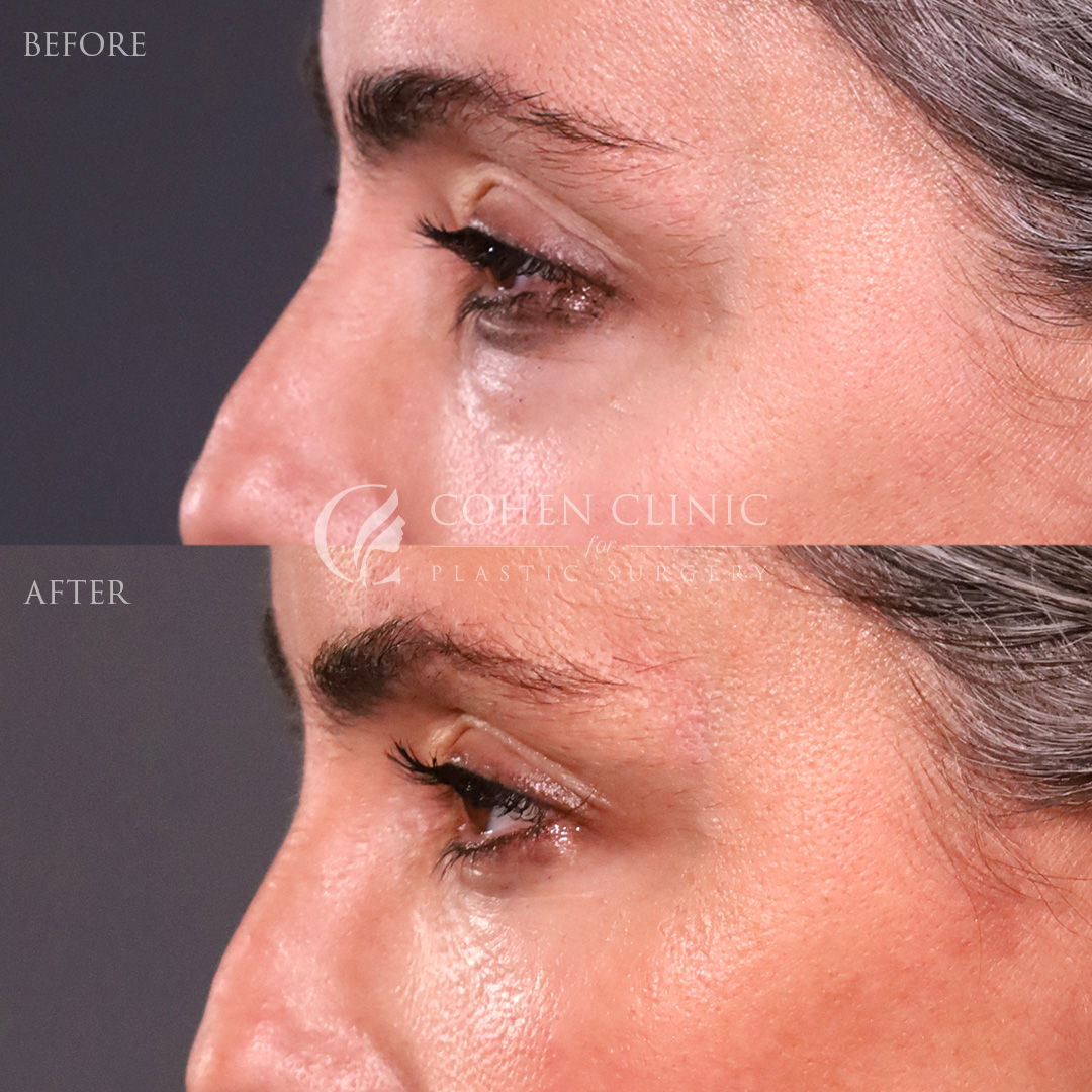 Case 34557 Marge Image