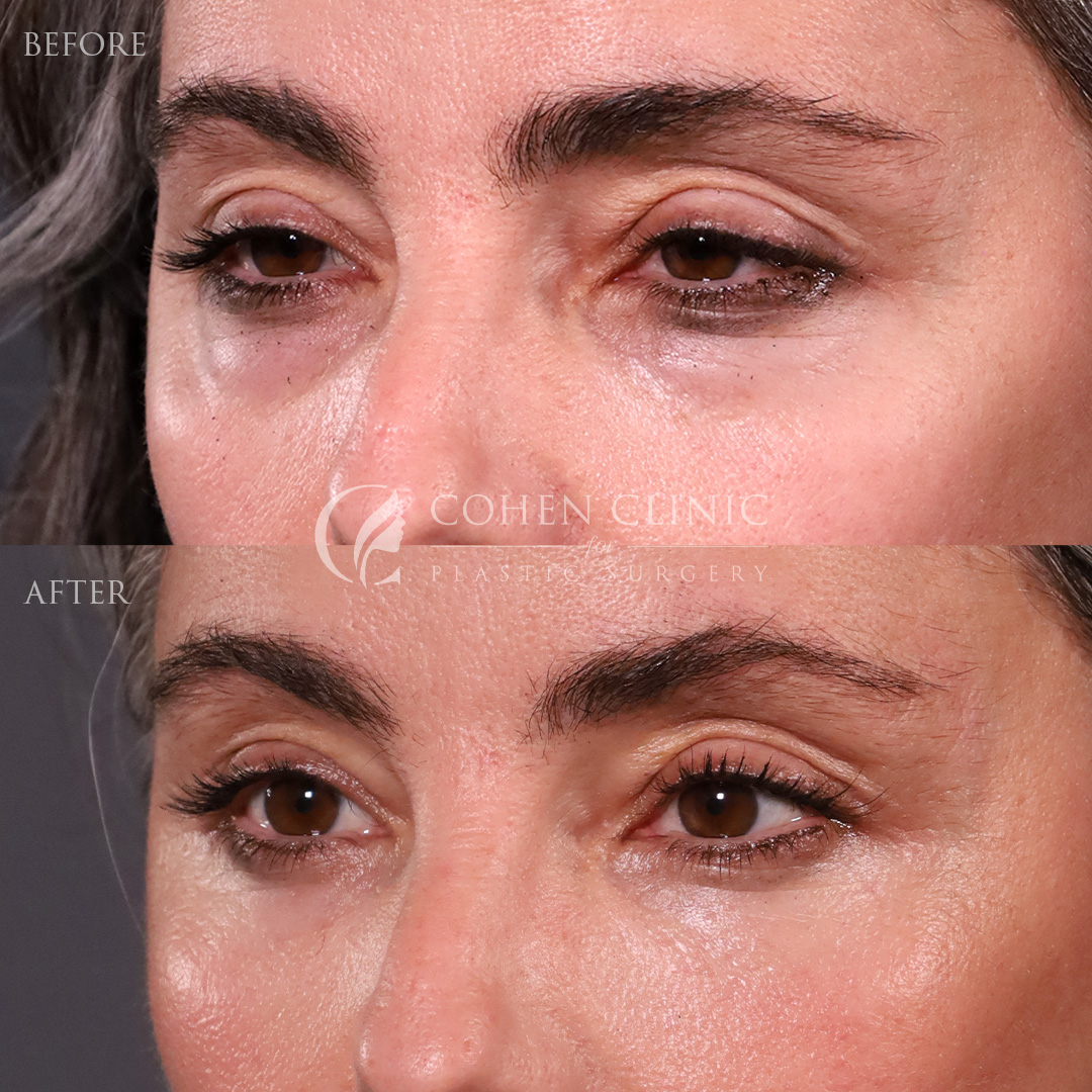 Case 34557 Marge Image