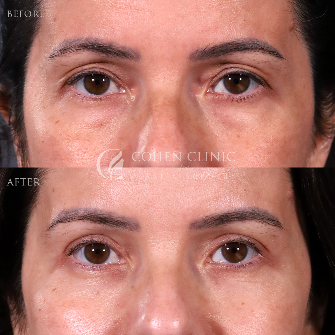 Case 22114 Marge Image