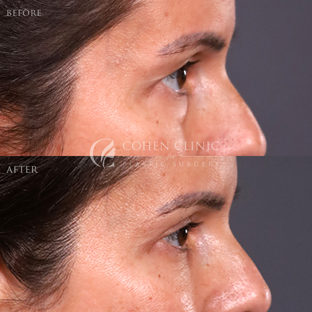 Case 22114 Marge Image