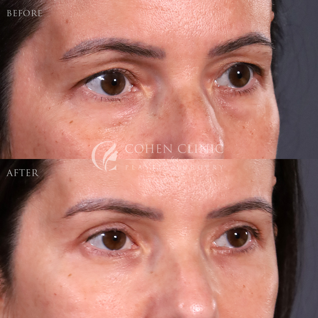 Case 22114 Marge Image