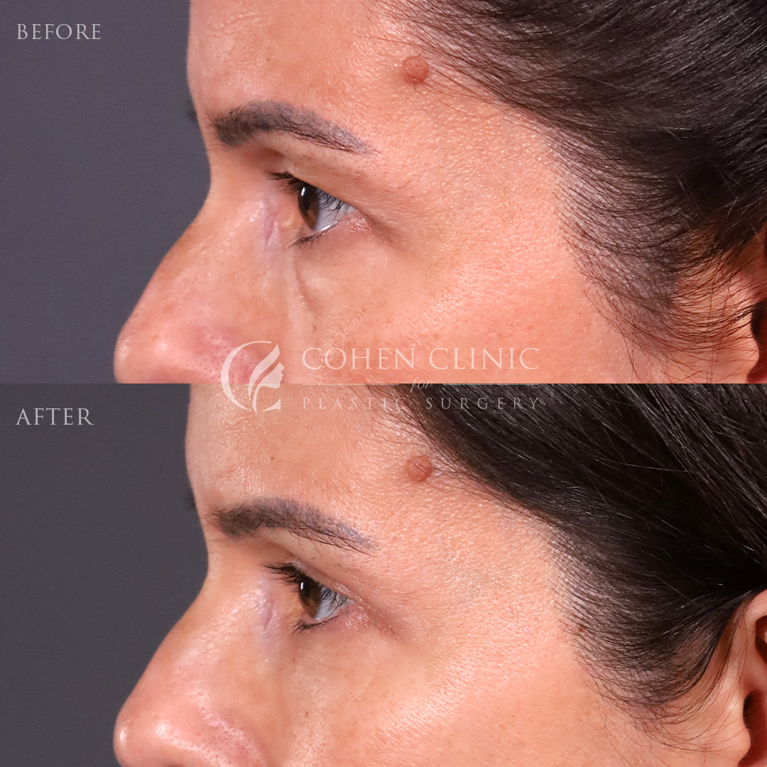 Case 22114 Marge Image