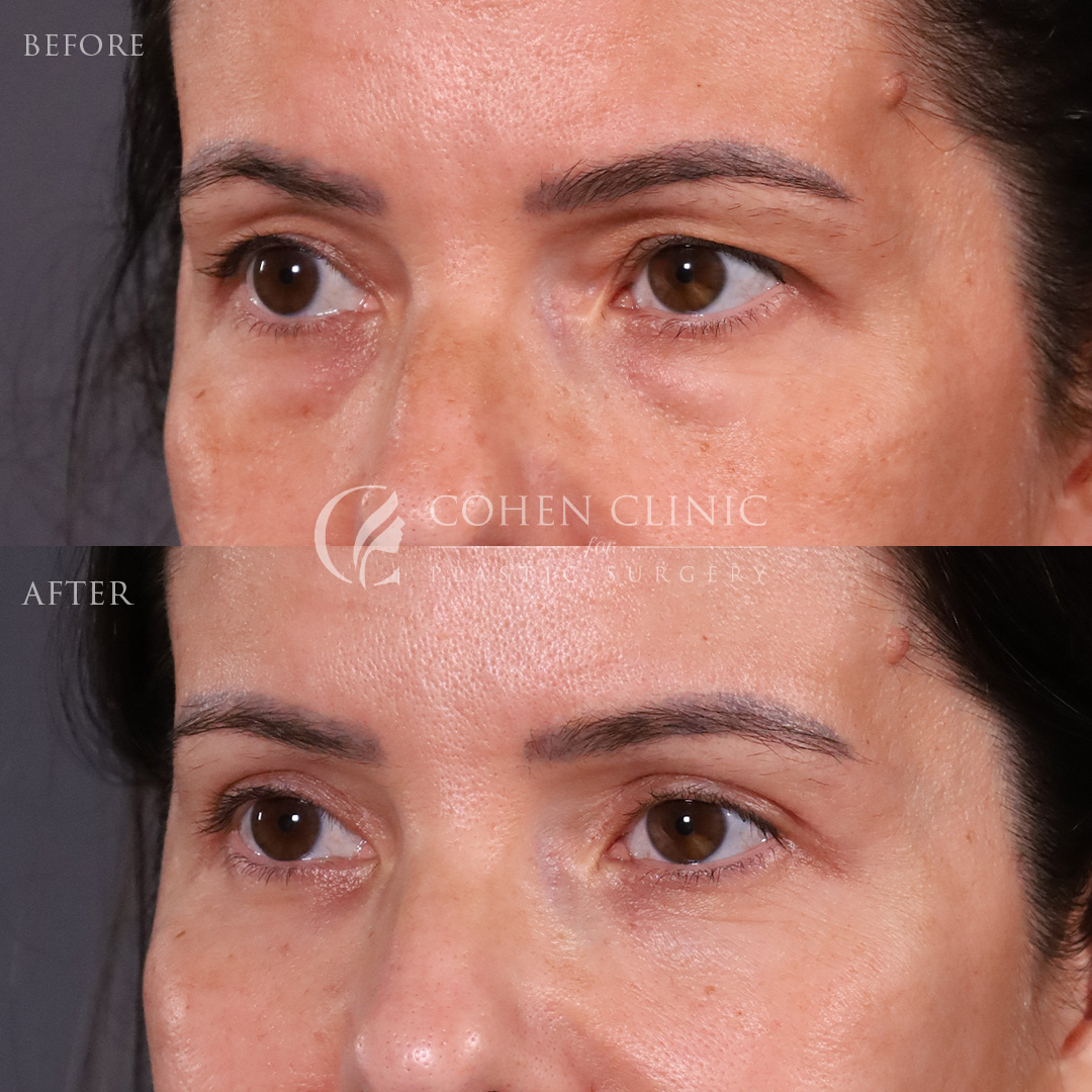 Case 22114 Marge Image