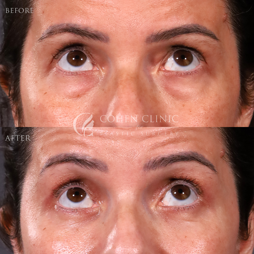 Case 22114 Marge Image