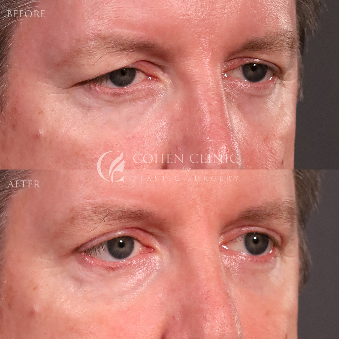 Case 66784 Marge Image