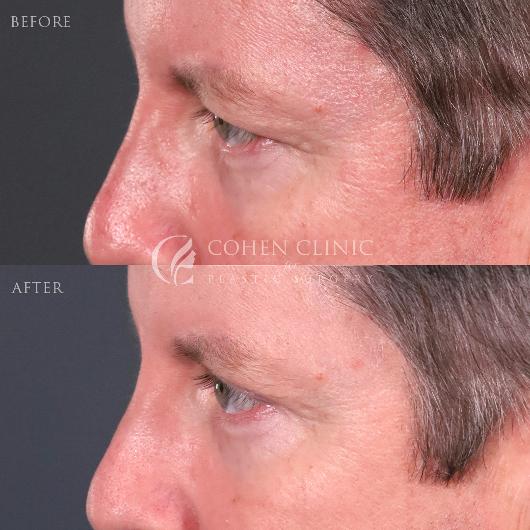 Case 66784 Marge Image