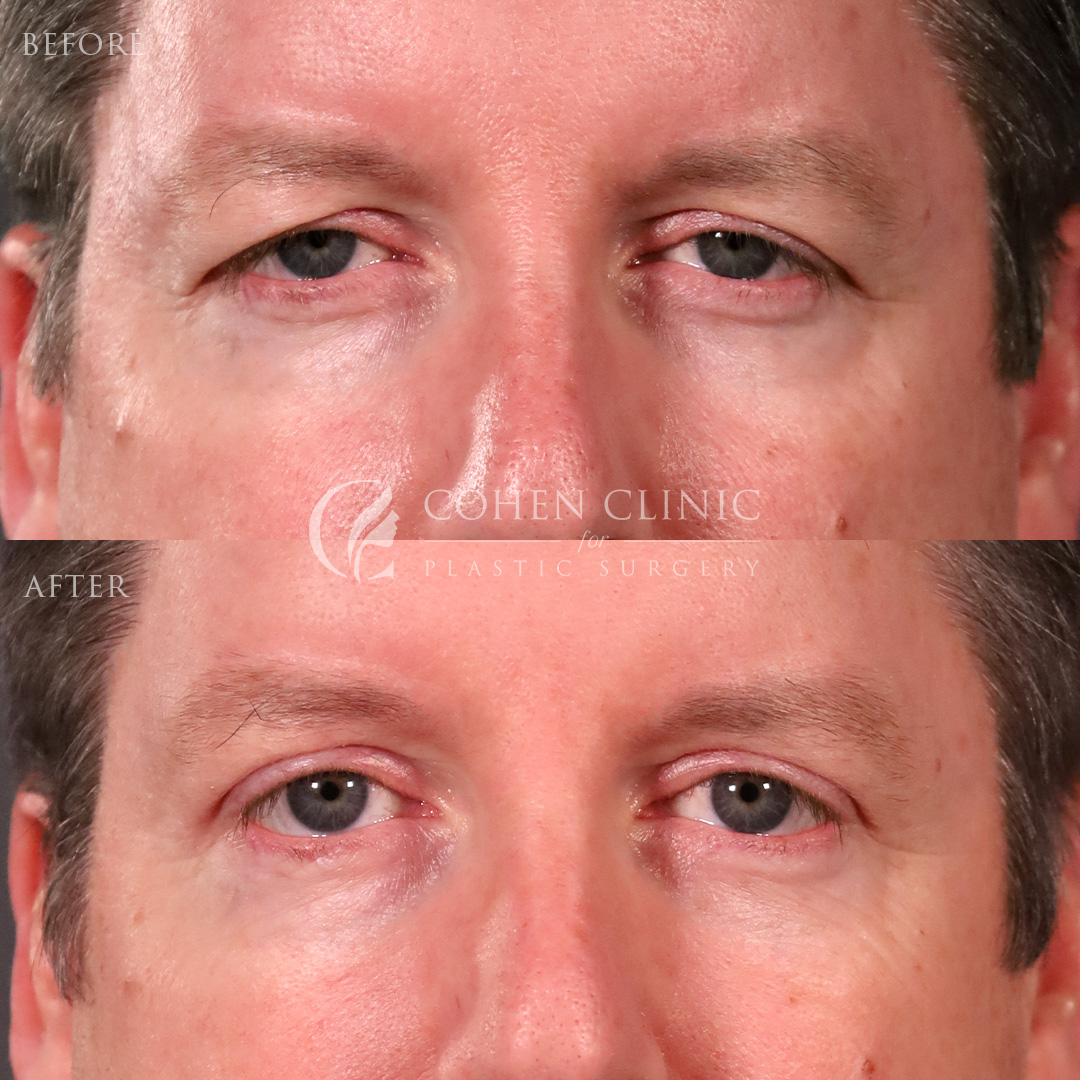 Case 66784 Marge Image