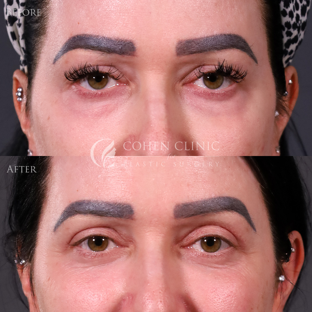 Case 65445 Marge Image