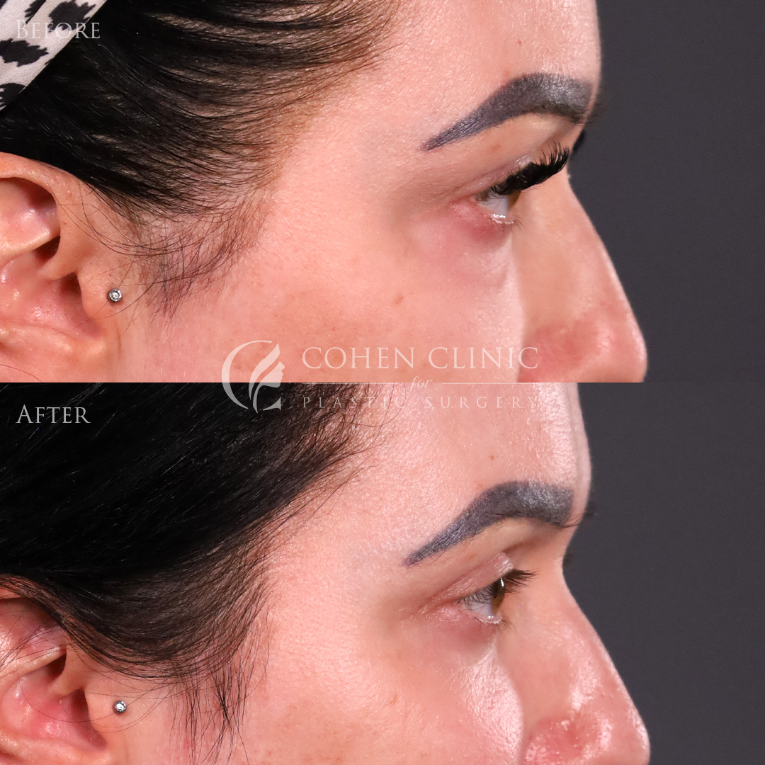 Case 65445 Marge Image