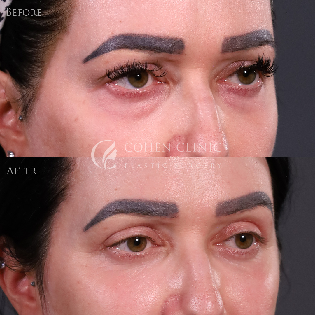 Case 65445 Marge Image