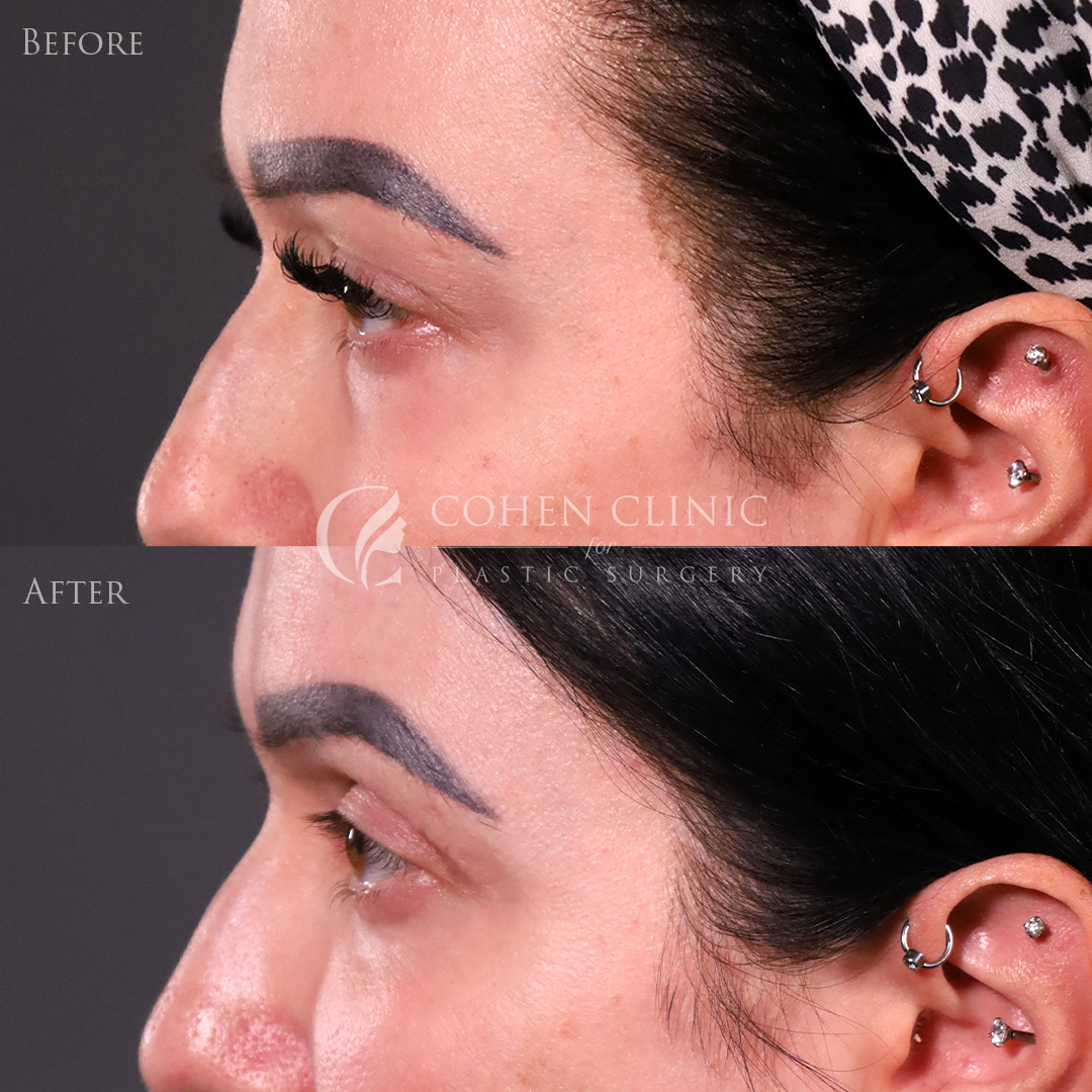 Case 65445 Marge Image