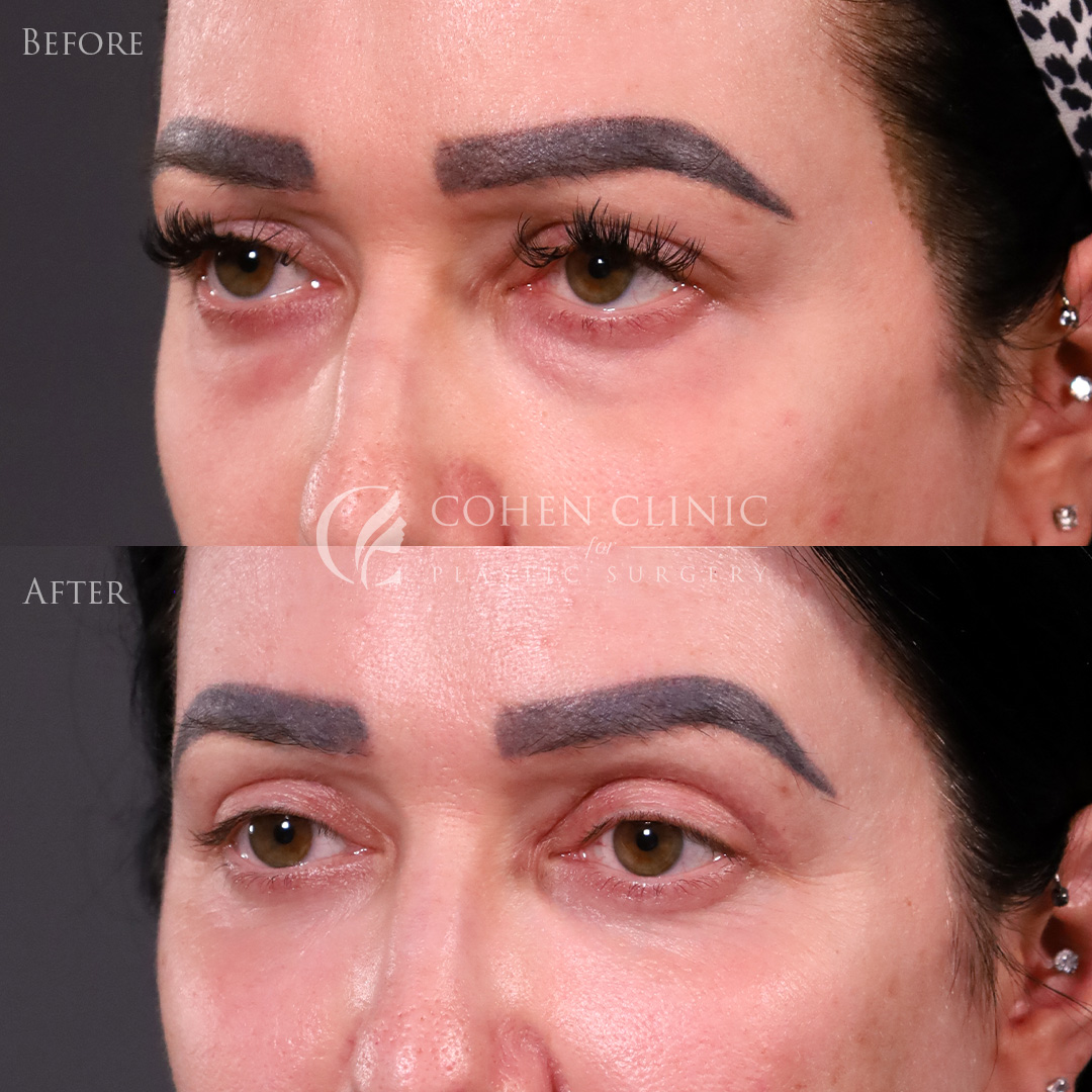 Case 65445 Marge Image