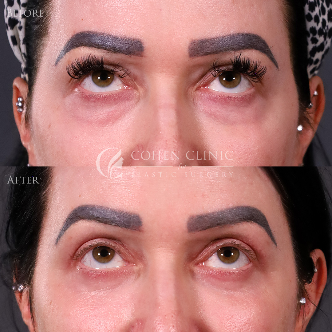 Case 65445 Marge Image