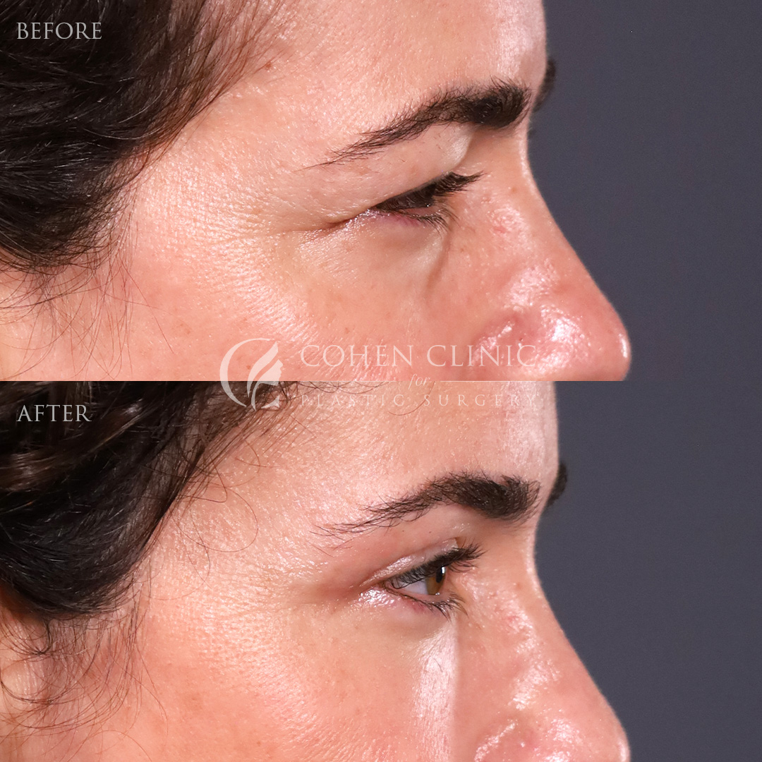 Case 47755 Marge Image