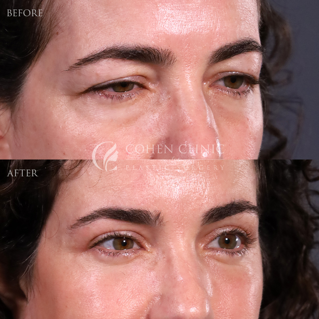 Case 47755 Marge Image