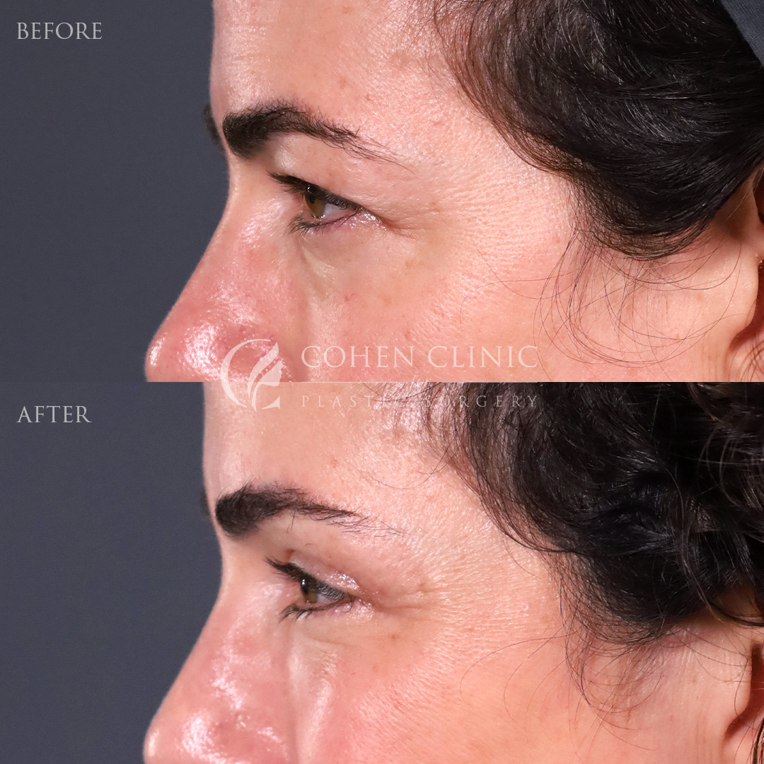 Case 47755 Marge Image