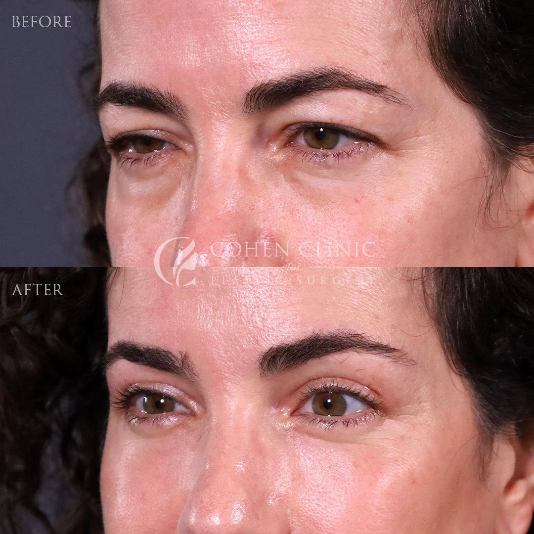 Case 47755 Marge Image