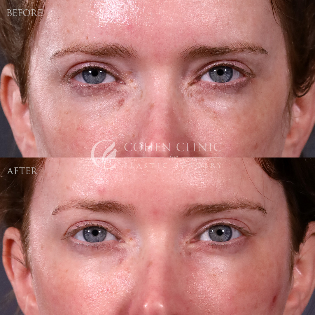 Case 88799 Marge Image