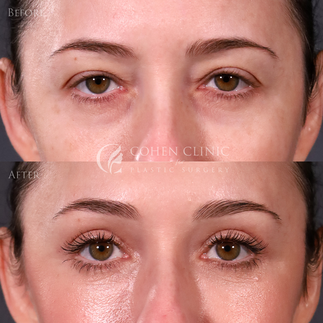 Case 69985 Marge Image