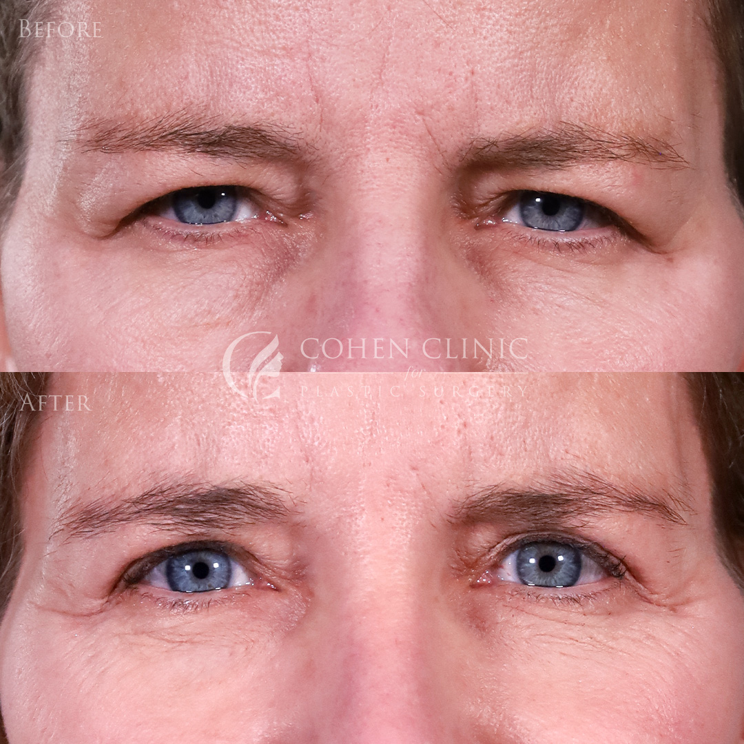 Case 22345 Marge Image