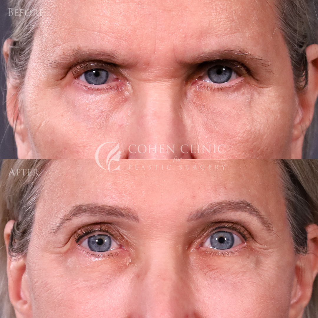 Case 65711 Marge Image