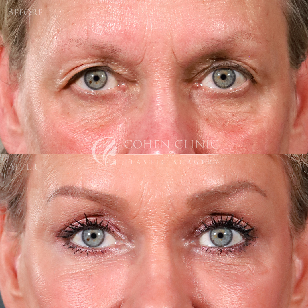 Case 00456 Marge Image