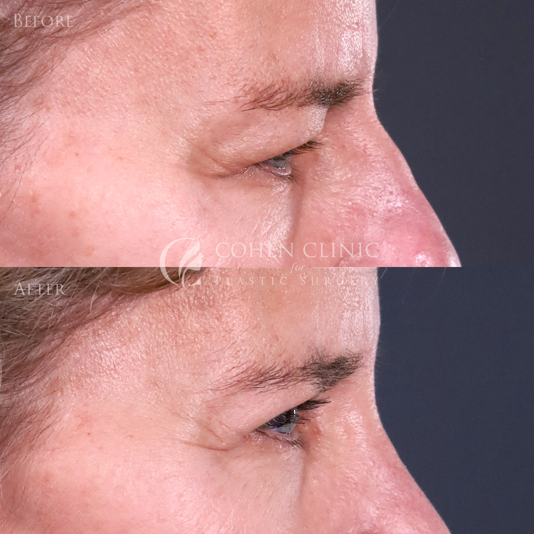 Case 22345 Marge Image