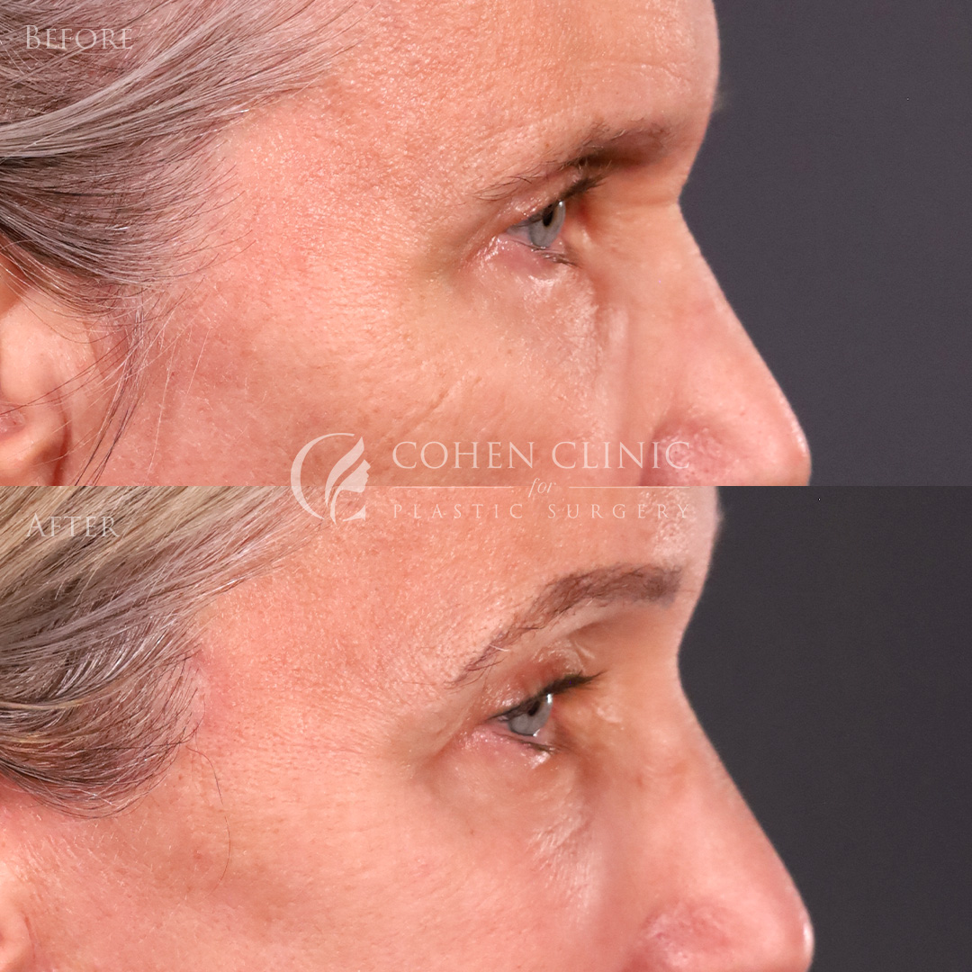 Case 65711 Marge Image