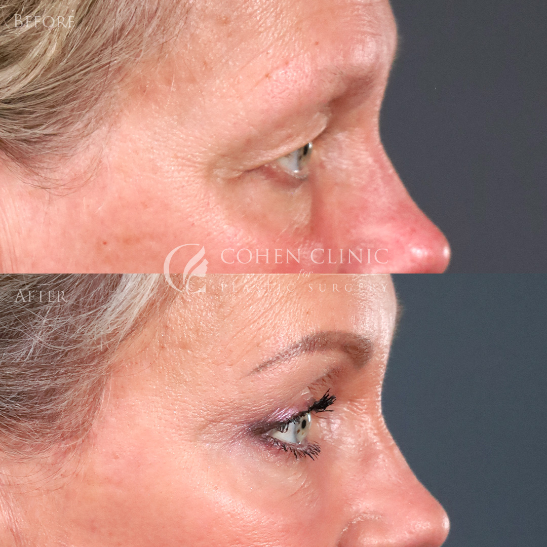 Case 00456 Marge Image